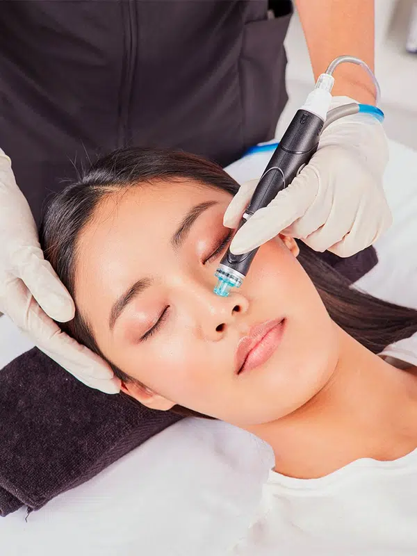 Hydrafacial Treatment